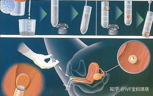 试管费用_1